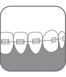Детская ортодонтическая зубная щетка, ORTHO BRUSH CHILD, Paro - фото