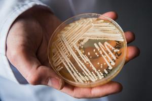 Кандидозная грибковая инфекция и способы борьбы с ней